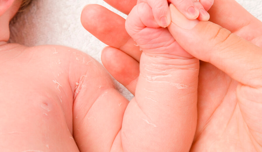 maternidad y adopcion